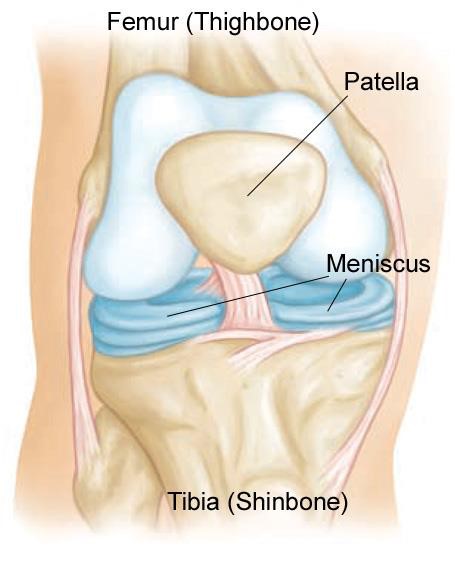 Meniscal tears 1