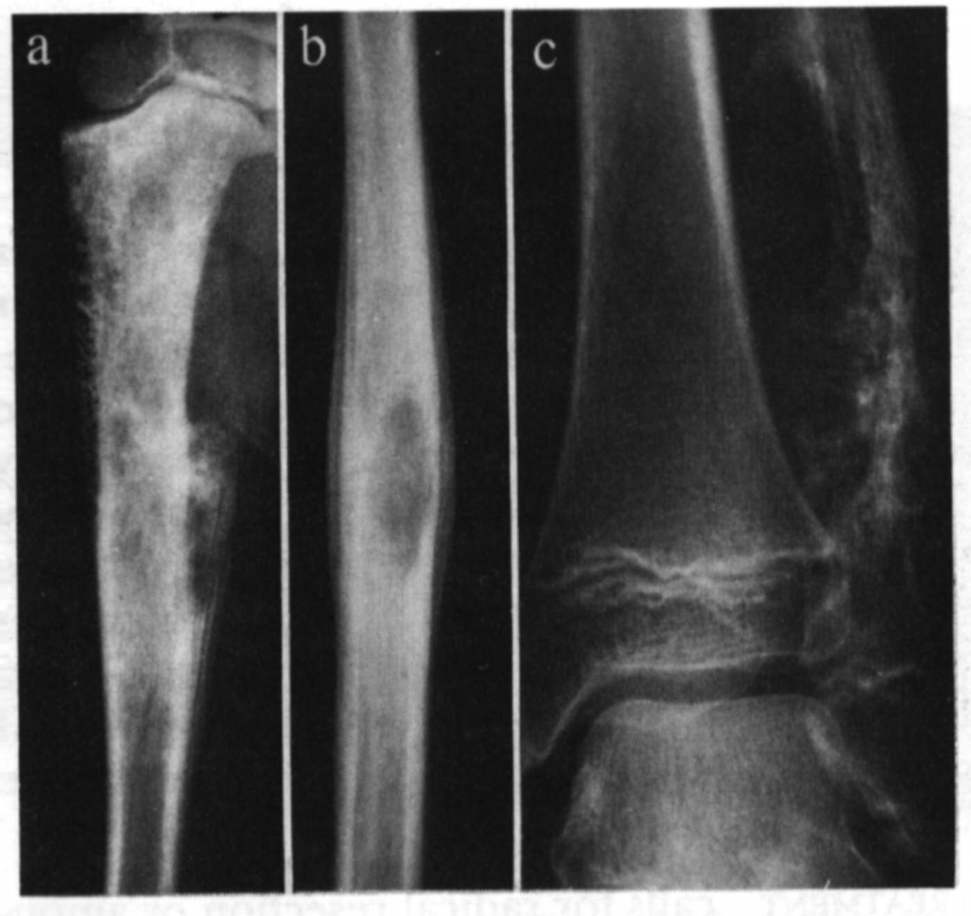 Tumours of unknown unusual origin 5