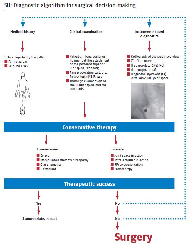 Sacroiliac Joint Dysfunction Diagnosis 1